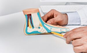 Articulação metatarsofalangeana do hálux: conhecendo a anatomia completa