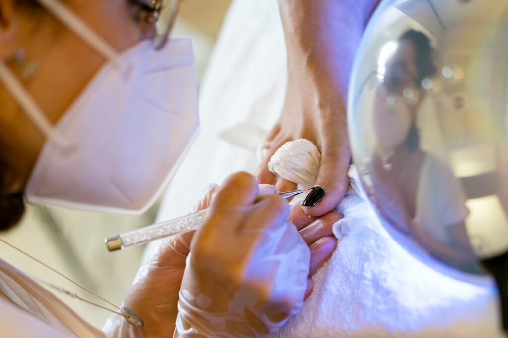 Cirurgia Estética no Pé: Como Funciona o Procedimento