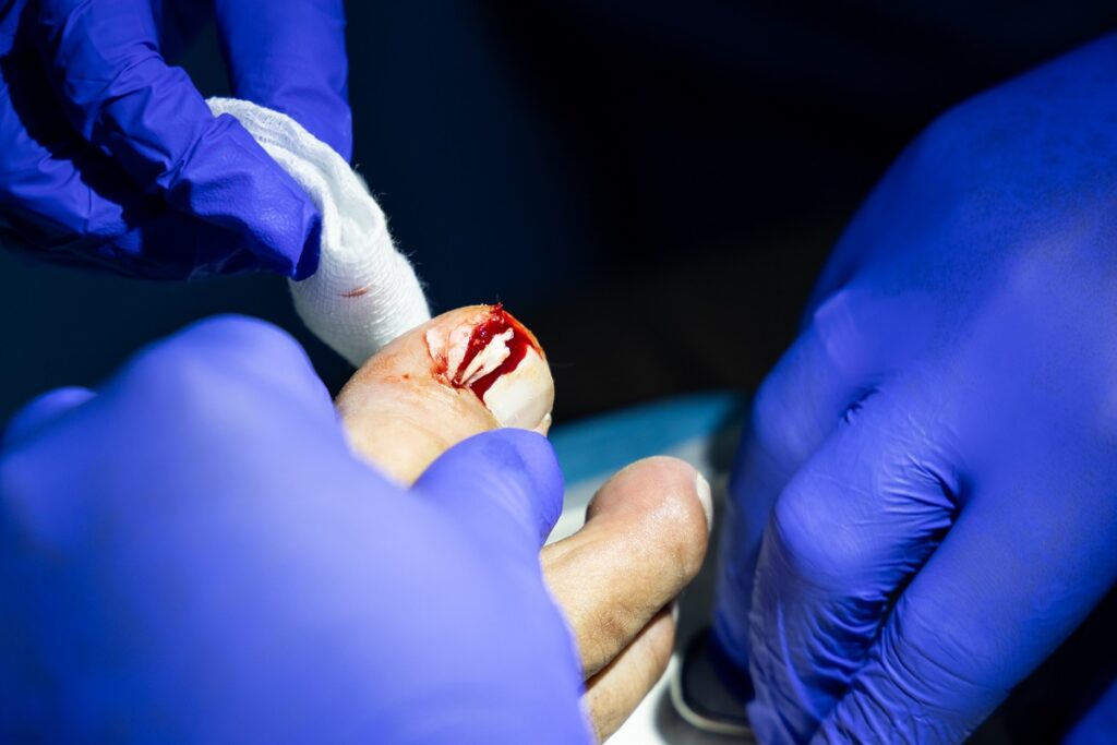 Cirurgia Plástica nos Pés: Opções e Resultados Esperados