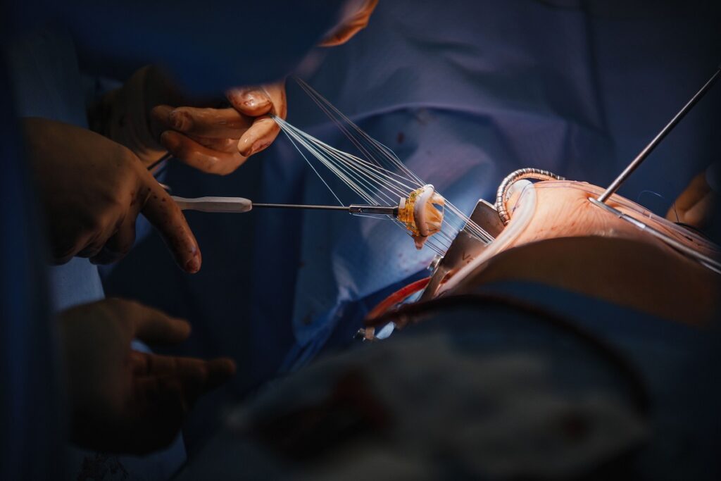 Cirurgia de Ligamento do Tornozelo: Procedimento e Recuperação