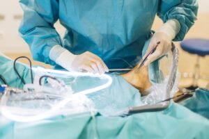 Cirurgia de Tendão do Pé: quando é necessária e como é a recuperação?