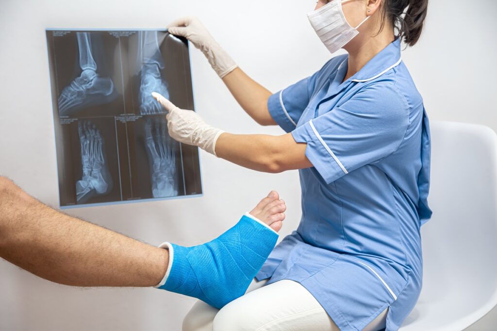 Cirurgia de fratura de tornozelo: como é feita e sua recuperação