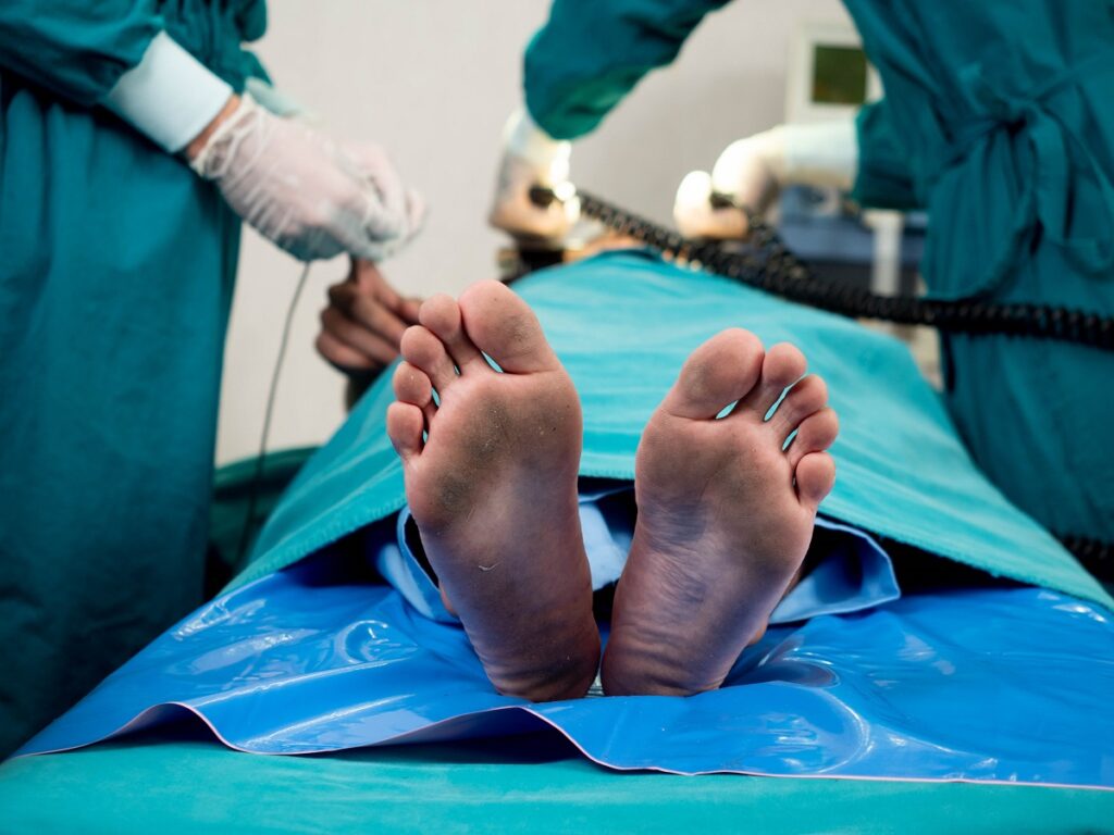 Cirurgia pé torto: como é feita e seus benefícios