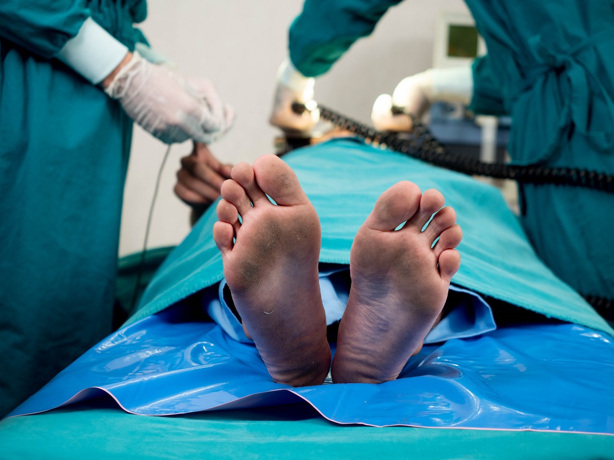 Fascite plantar cirurgia: procedimento e tempo de recuperação
