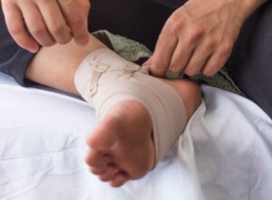 Fratura Oblíqua de Tornozelo: como identificar e qual o melhor tratamento?