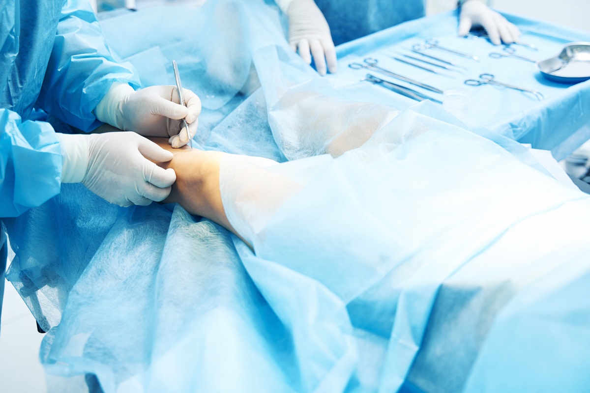 Como é feita a cirurgia do pé e tornozelo?
