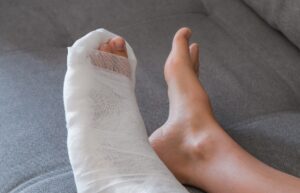 Dedo do pé quebrado: quanto tempo de recuperação?