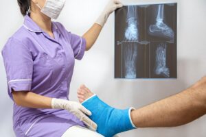 Fraturas no pé: quais os tipos podem ocorrer e quais cuidados tomar?