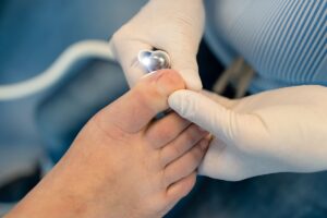 Quanto tempo leva a recuperação da cirurgia de hallux rigidus?
