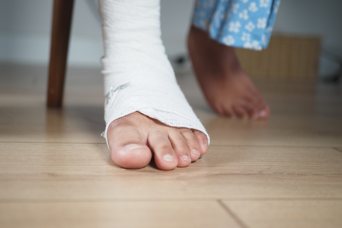 Pé quebrado: tempo de recuperação esperado